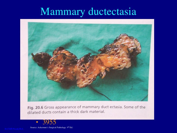 breast surgical pathology Breast surgical pathology